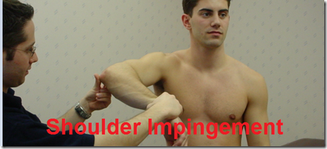 shoulder impingement shoulder impingement